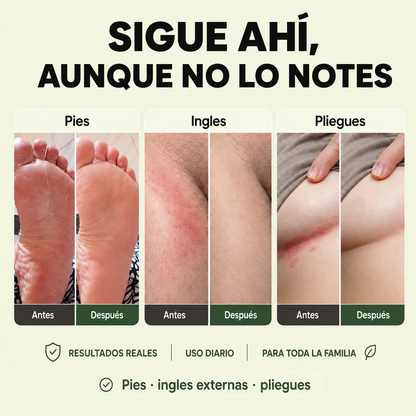 Jabón Antifúngico Dermax™